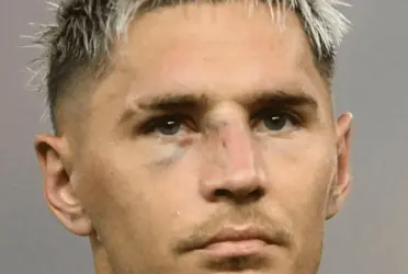 Lateral apareceu visivelmente machucado após agressão no treino